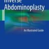 Inverse Abdominoplasty 2016 : An Illustrated Guide