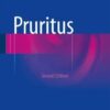 Pruritus, 2nd Edition