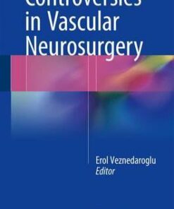 Controversies in Vascular Neurosurgery 2016