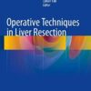 Operative Techniques in Liver Resection 2016