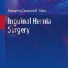 Inguinal Hernia Surgery 2017