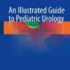 An Illustrated Guide to Pediatric Urology 2017