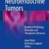 Neuroendocrine Tumors: Review of Pathology, Molecular and Therapeutic Advances 1st ed. 2016 Edition