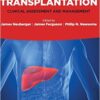 Liver Transplantation: Clinical Assessment and Management 1st Edition