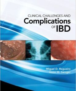 Clinical Challenges and Complications of IBD 1st Edition