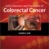 Early Detection and Prevention of Colorectal Cancer (Curbside Consultation) 1st Edition