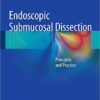 Endoscopic Submucosal Dissection: Principles and Practice 2015th Edition