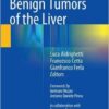 Benign Tumors of the Liver  1st ed. 2015 Edition