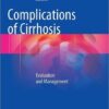 Complications of Cirrhosis: Evaluation and Management 1st ed. 2015 Edition