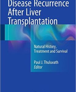 Disease Recurrence After Liver Transplantation: Natural History, Treatment and Survival 1st ed. 2016 Edition