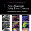 Clinical Dilemmas in Non-Alcoholic Fatty Liver Disease 1st Edition