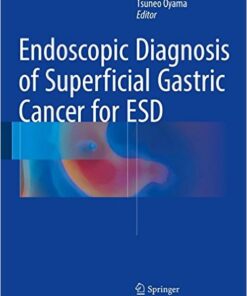 Endoscopic Diagnosis of Superficial Gastric Cancer for ESD 1st ed. 2016 Edition