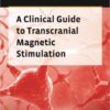 A Clinical Guide to Transcranial Magnetic Stimulation 1st Edition