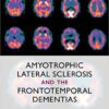 Amyotrophic Lateral Sclerosis and the Frontotemporal Dementias 1st Edition