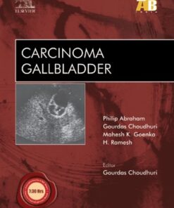 Carcinoma Gallbladder - ECAB