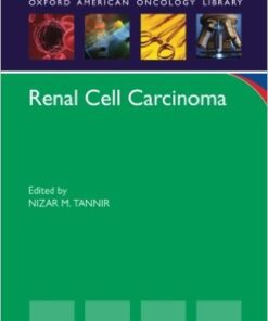 Renal Cell Carcinoma 1st Edition