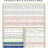 Handbook of ICU EEG Monitoring 1st Edition