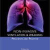 Non-invasive Ventilation and Weaning: Principles and Practice Har/Psc Edition
