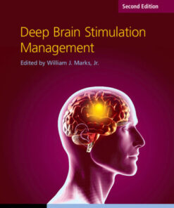 Deep Brain Stimulation Management 2nd Edition PDF