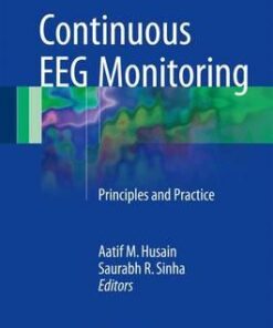 Continuous EEG Monitoring: Principles and Practice 1st ed. 2017 Edition PDF