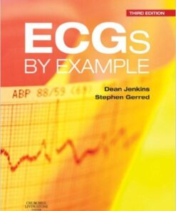 ECGs by Example, 3e 3rd Edition