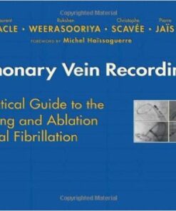 Pulmonary Vein Recordings: A Practical Guide to the Mapping and Ablation of Atrial Fibrillation 2nd Edition