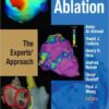 Hands-on Ablation: The Experts' Approach 1st Edition