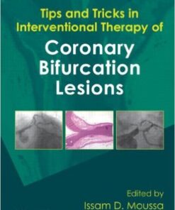 Tips and Tricks in Interventional Therapy of Coronary Bifurcation Lesions 1st Edition