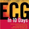 ECG in Ten Days, 2nd Edition