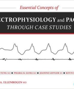 Essential Concepts of Electrophysiology and Pacing through Case Studies