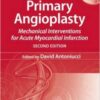 Primary Angioplasty: Mechanical Interventions for Acute Myocardial Infarction