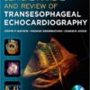 Clinical Manual and Review of Transesophageal Echocardiography, 2nd Edition