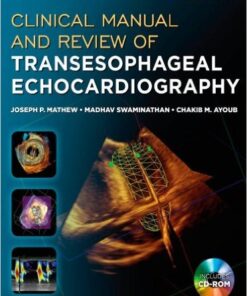 Clinical Manual and Review of Transesophageal Echocardiography, 2nd Edition