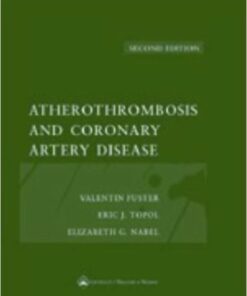 Atherothrombosis and Coronary Artery Disease Edition 2