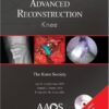 Advanced Reconstruction: Knee PDF