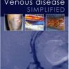 Venous Disease Simplified