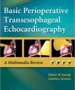 Basic Perioperative Transesophageal Echocardiography