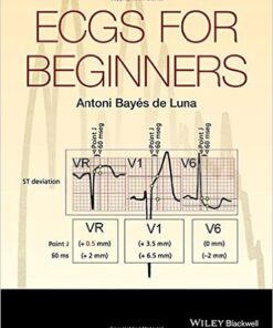 ECGs for Beginners