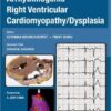 Current Concepts in Arrhythmogenic Right Ventricular Cardiomyopathy/Dysplasia