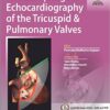 Transesophageal Echocardiography of the Tricuspid and Pulmonary Valves