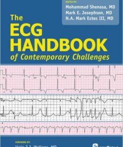 The ECG Handbook of Contemporary Challenges