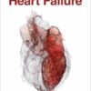 The 4 Stages of Heart Failure