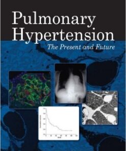Pulmonary Hypertension : The Present and Future