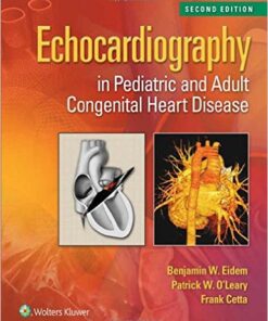 Echocardiography in Pediatric and Adult Congenital Heart Disease, 2nd Edition Retail PDF