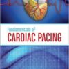 Fundamentals of Cardiac Pacing