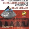 Transesophageal Echocardiography of Congenital Heart Diseases