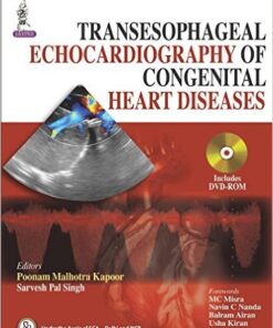 Transesophageal Echocardiography of Congenital Heart Diseases