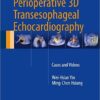 Atlas of Perioperative 3D Transesophageal Echocardiography 2016 : Cases and Videos