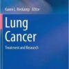 Lung Cancer 2016 : Treatment and Research