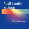 Adult Lumbar Scoliosis: A Clinical Guide to Diagnosis and Management 1st ed. 2017 Edition
